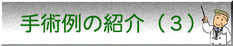 �`���O�Ȃ̗��j�i�R�j