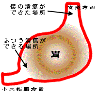 ��ᇂ̂ł��镔��