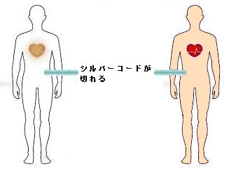 死と言う現象とは