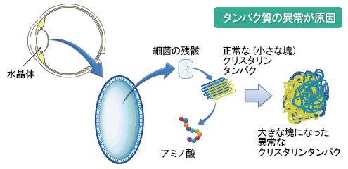 タンパク質の異常が原因