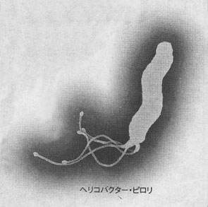 pylori