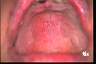 erythematodesimg0033.jpg