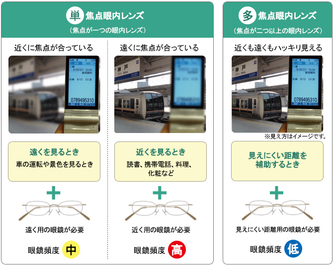 眼内レンズ別眼鏡使用頻度