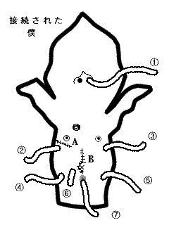 僕の体に挿入されているチューブの図