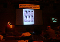 lipidosis.jpg (13827 $B%P%$%H(B)