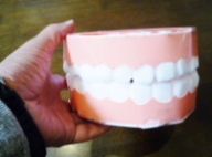 歯形の模型