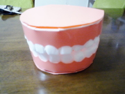 歯型の模型の完成