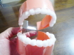 歯形の模型