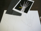 手の輪郭と骨の輪郭を写します