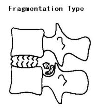 fragmented disk