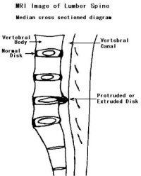 MRI image