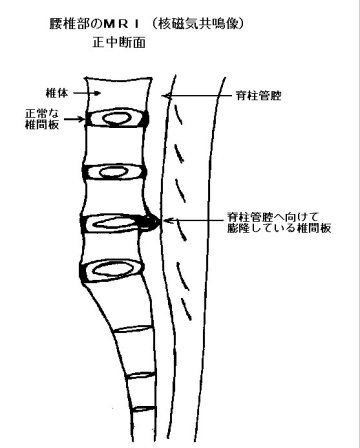 mri