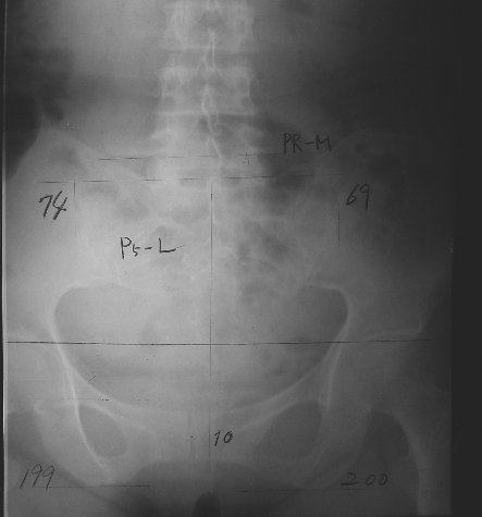 xray01