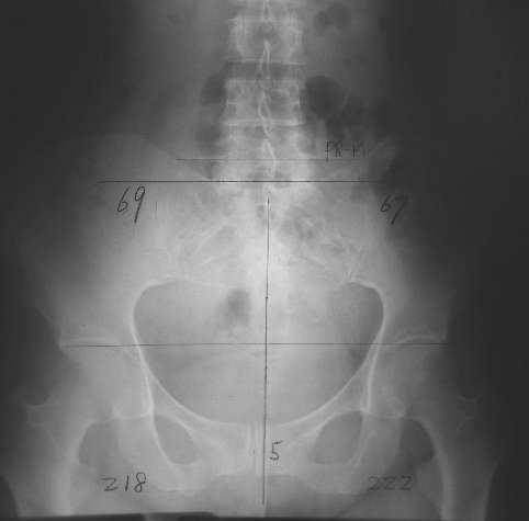 xray02