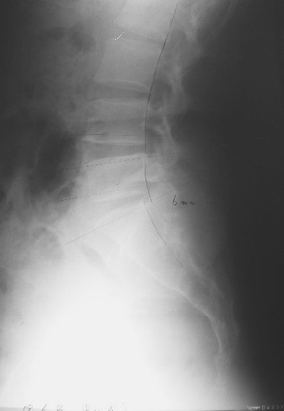 xray03