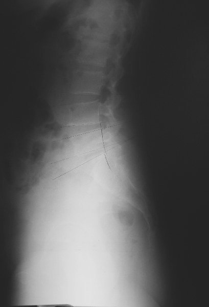 xray04