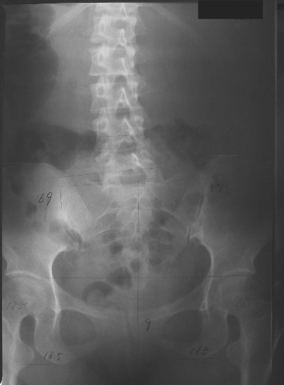 xray05