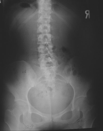 xray06