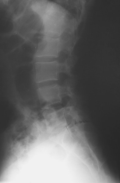 xray07