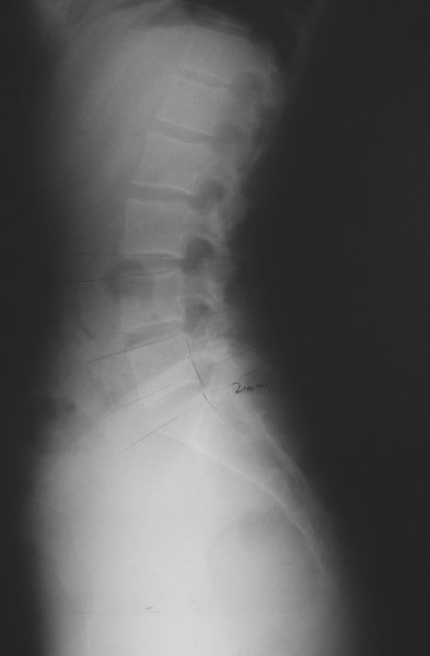 xray08