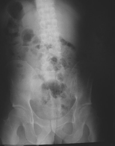 xray09