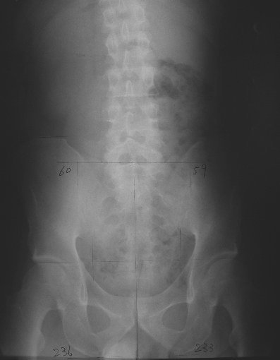 xray10