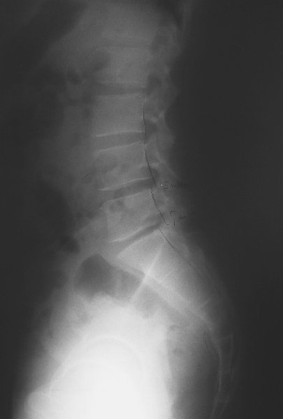 xray11