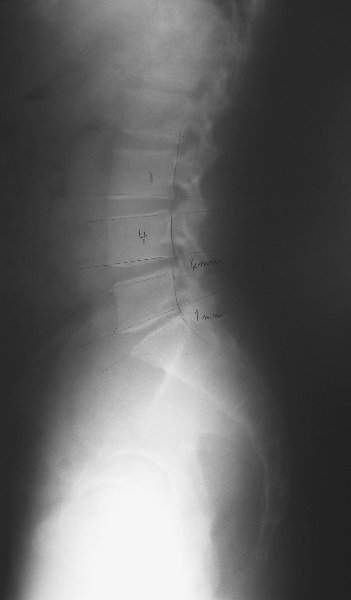 xray12