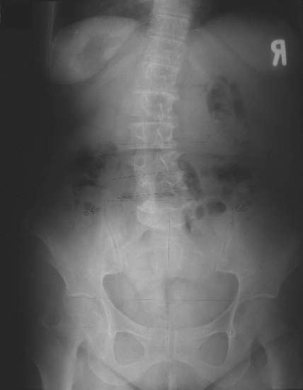 xray14