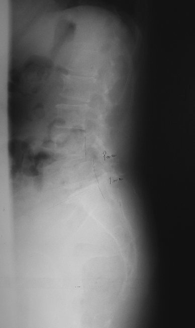 xray16