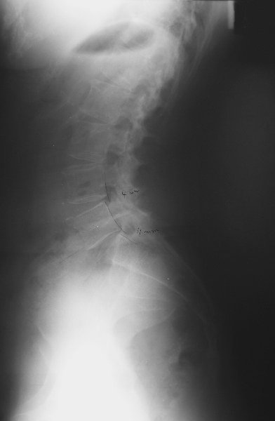 xray18
