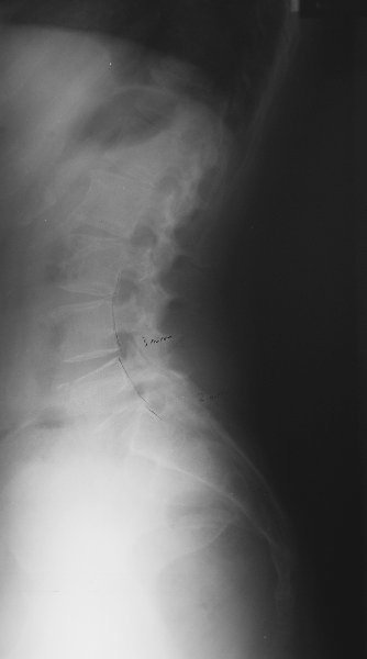 xray19