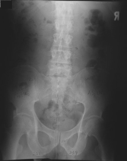 xray20