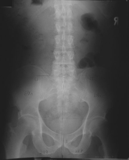 xray21