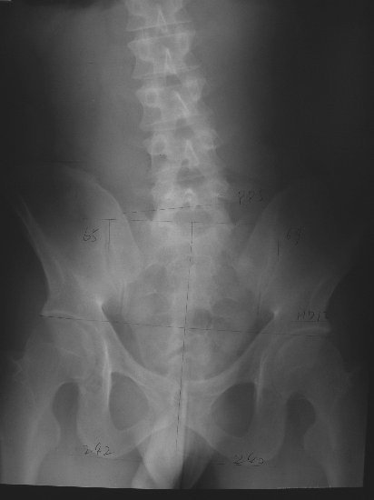 xray24