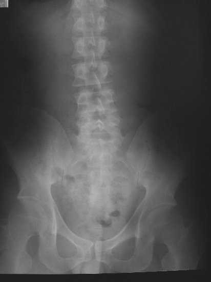 xray25