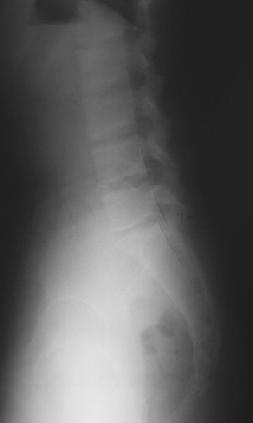 xray26