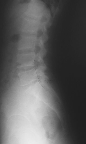 xray27