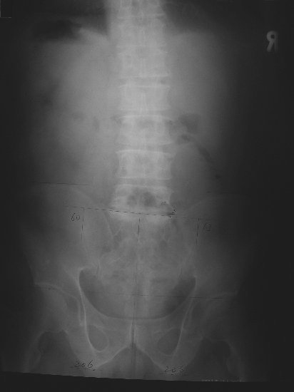 xray28