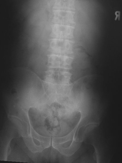 xray29