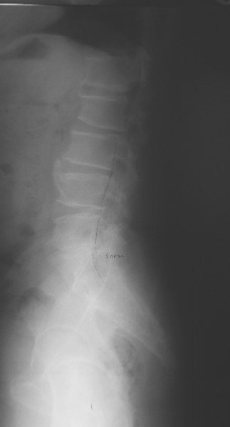 xray31