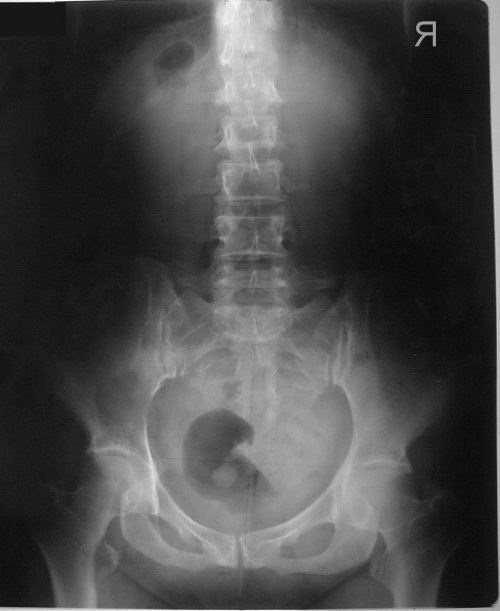 xray31