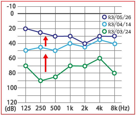 めまい・メニエール病