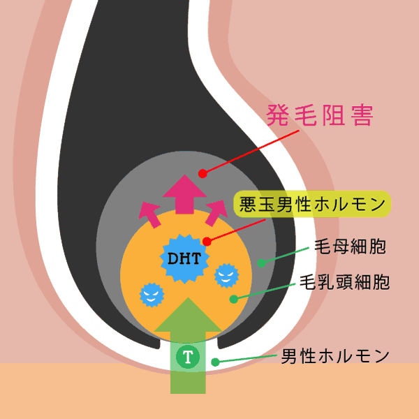 薄毛の原因