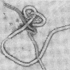 Ebora Virus